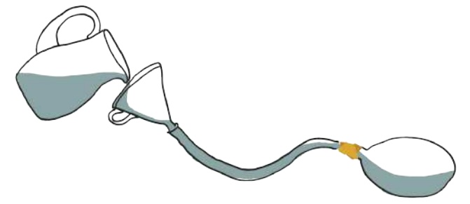 Ilustração de um funil instalado na extremidade de uma mangueira, cuja outra ponta está presa ao bico de uma bexiga. A água de uma jarra é despejada no funil, descendo pela mangueira até o interior da bexiga.