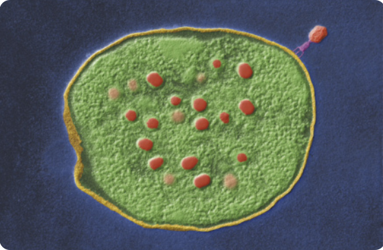 Imagem microscópica de bactéria Escherichia coli. Possui formato arredondado, possui membrana e pequenas estruturas esféricas em seu interior. Sobre sua superfície está um pequeno vírus bacteriófago.