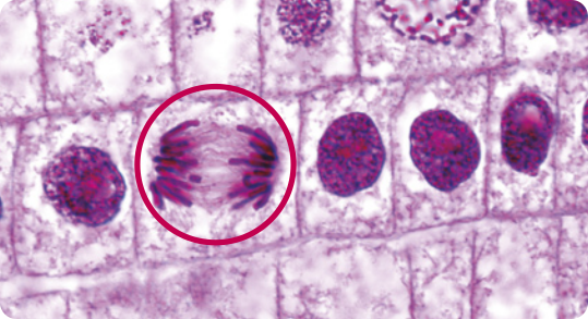 Imagem de microscopia de células vegetais retangulares. No centro, em destaque, estão cinco células lado a lado, quatro delas têm o núcleo circular colorido de roxo com o nucléolo vermelho. Uma delas está circulada, em vermelho, e não tem o núcleo visível, mas é possível ver o material genético dividido e organizado em cromátides. Metade das cromátides está no lado esquerdo e metade está no lado direito da célula e estão conectadas por filamentos finos.