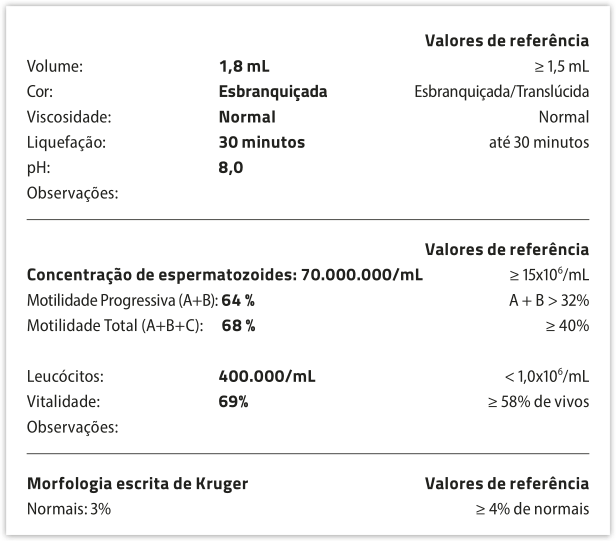 Tabela contendo as seguintes informações sobre o espermograma: Volume: 1,8 mililitros. Valor de referência: maior ou igual a 1,5 mililitros. Cor: Esbranquiçada. Valor de referência: esbranquiçada ou transparente. Viscosidade: Normal. Valor de referência: normal. Liquefação: 30 minutos. Valor de referência: até 30 minutos. p h: 8 Sem observações. Concentração de espermatozoides: 70 milhões por mililitro. Valor de referência: maior ou igual a 150 mil por mililitro. Motilidade Progressiva (A mais B): 64 por cento. Valor de referência: A mais B maior que 32 por cento. Motilidade Total (A mais B mais C): 68 por cento. Valor de referência: maior ou igual a 40 por centro. Leucócitos: 400 mil por mililitro. Valor de referência: menor do que 1 milhão por mililitro. Vitalidade: 69 por cento. Valor de referência: maior ou igual 58 por cento de vivos. Sem observações. Morfologia escrita de Kruger:  Normais: 3 por cento. Valor de referência: maior ou igual a 4 por cento de normais.