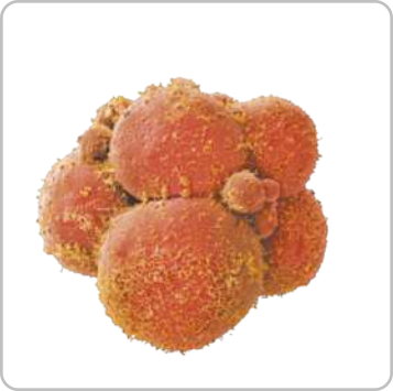 Imagem de microscopia de células esféricas agrupadas, de tamanhos diferentes, algumas maiores, outras consideravelmente menores.
