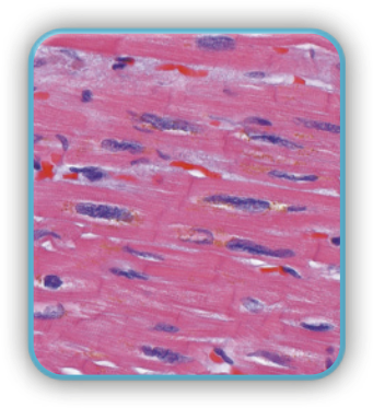 Imagem de microscopia do tecido muscular estriado cardíaco formado por diversas células de aspecto cilíndrico, são ramificadas e apresentam extremidades irregulares.