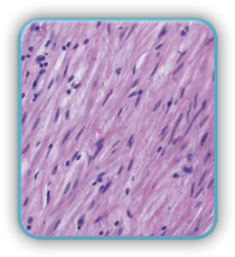 Imagem de microscopia do tecido muscular. Suas células são longas, com um núcleo central e suas extremidades são mais estreitas que o seu centro.
