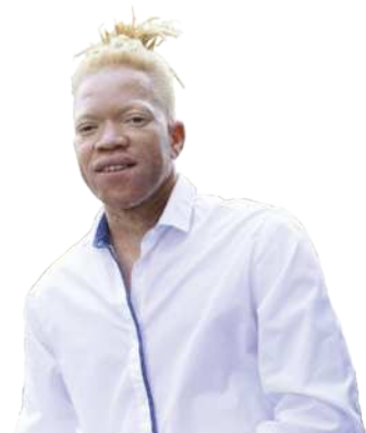 Fotografia de um homem albino sorrindo para a foto. Veste uma camisa e tem dreads.