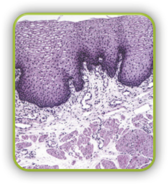 Imagem microscópica do tecido epitelial de revestimento. É possível identificar uma camada de inúmeras células justapostas, sem espaço entre elas. Abaixo desta camada está outra com células espaçadas e de diferentes tamanhos.