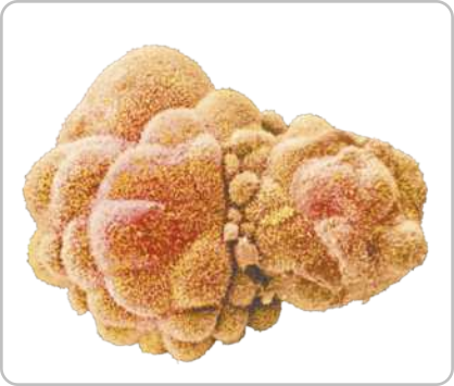 Imagem de microscopia de um embrião. Amontoado de células sem forma definida, existem células maiores e menores.