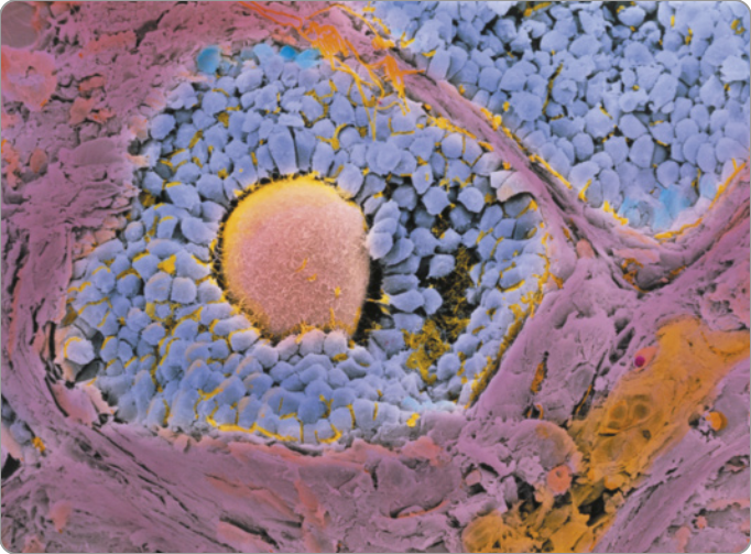 Imagem de microscopia mostrando o ovócito, célula esférica rodeada por inúmeras pequenas estruturas, de formato arredondado, que estão, por sua vez, dentro do folículo ovariano, estrutura que forma uma espécie de cápsula.