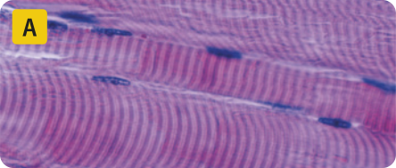 A. Imagem microscópica de tecido com células longas, finas, cilíndricas e multinucleadas, dispostas paralelamente umas às outras, formando um conjunto de faixas paralelas e estriadas.