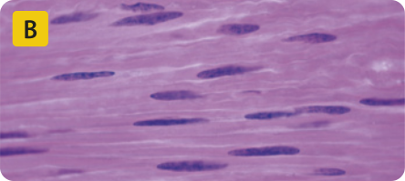 B. Imagem microscópica de tecido com células longas, com um núcleo central e com extremidades mais estreitas que o seu centro.