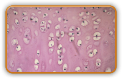Imagem de microscopia de pequenas células redondas e esparsas.