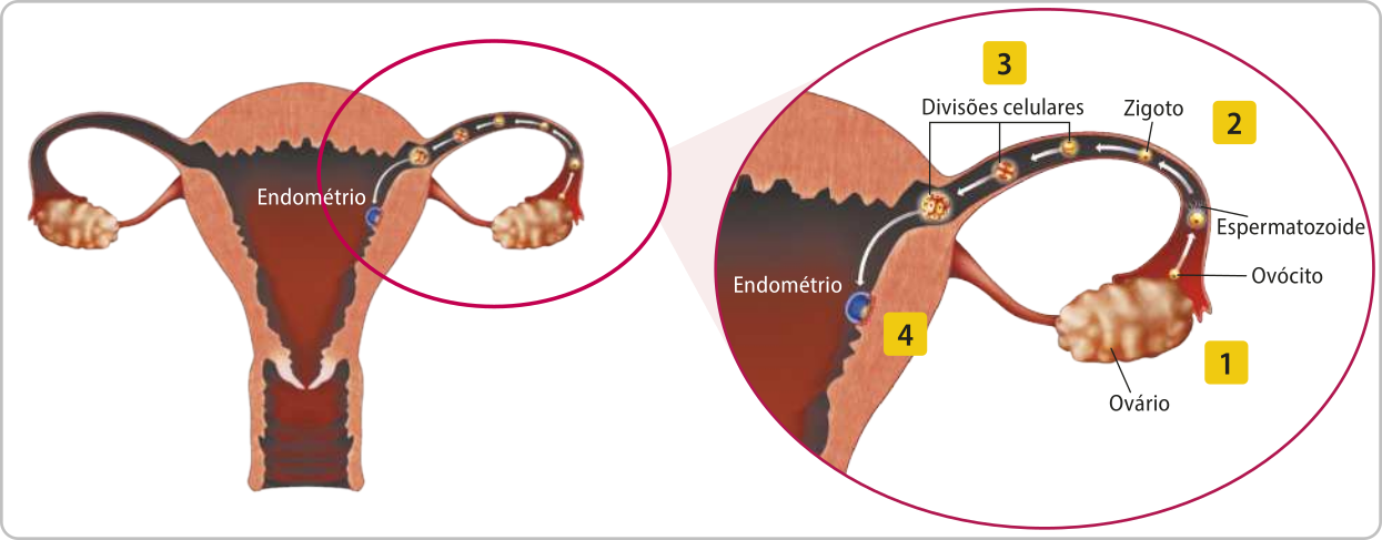 Esquema representando o sistema genital feminino com o ovário, o endométrio e a tubas uterina ampliados em detalhe, mostrando os seguintes eventos. 1. Ovulação: o ovócito sai do ovário para a tuba uterina. 2. Fecundação: o ovócito e o espermatozoide se unem e formam o zigoto. 3. Divisões celulares: o zigoto começa a se dividir e aumentar de tamanho ao longo da tuba uterina. 4. Implantação no endométrio: o blastocisto se fixa na parede do endométrio.
