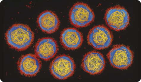 Imagem de microscopia mostrando os 11 vírus. Eles são arredondados com estruturas prismáticas no núcleo.