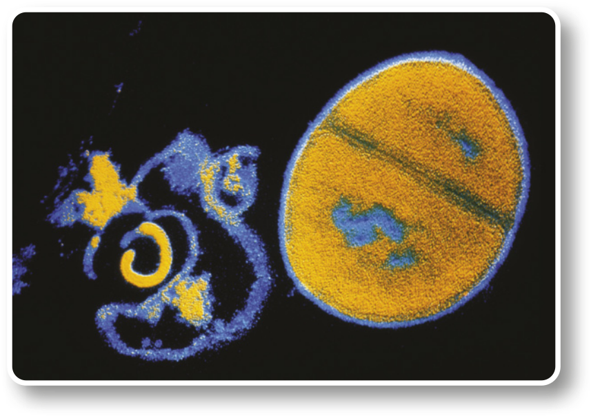 Imagem de microscopia com os restos de uma bactéria morta e de uma bactéria intacta, com uma linha divisória começando a surgir.