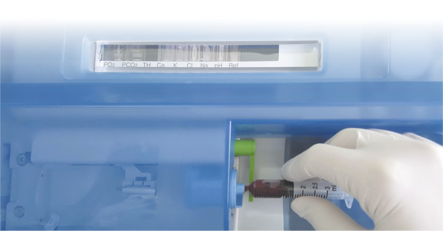 Fotografia de mão usando luva descartável enquanto manuseia uma seringa contendo sangue. A seringa está conectada em um compartimento de um equipamento laboratorial. Acima do compartimento, há um visor com uma etiqueta com as seguintes fórmulas químicas: P molécula de oxigênio com 2 átomos, P C molécula de oxigênio com 2 átomos, T H, C a, K, C l, N a, p H, Ref.