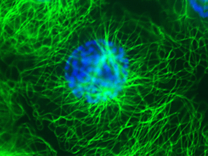 Fotografia microscópica. Há um emaranhado de fios verdes fluorescentes, os microtúbulos, espalhados por um fundo escuro. No centro deles, está o material genético, em formato circular e de cor azul, que reflete os fios verdes com sua luminosidade.
