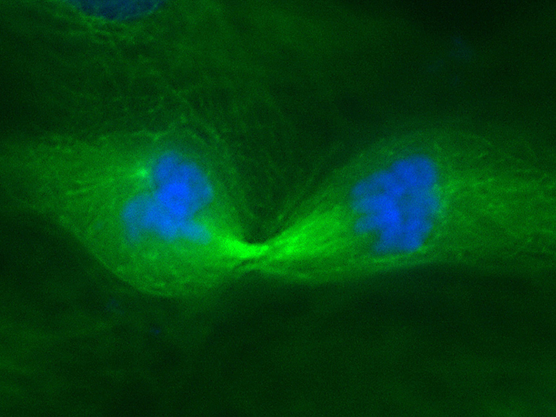 Fotografia microscópica. Há duas manchas verdes fluorescentes interligadas. No centro de cada uma dessas manchas, há uma mancha em azul, o material genético. O fundo da foto é escuro em tons esverdeados.