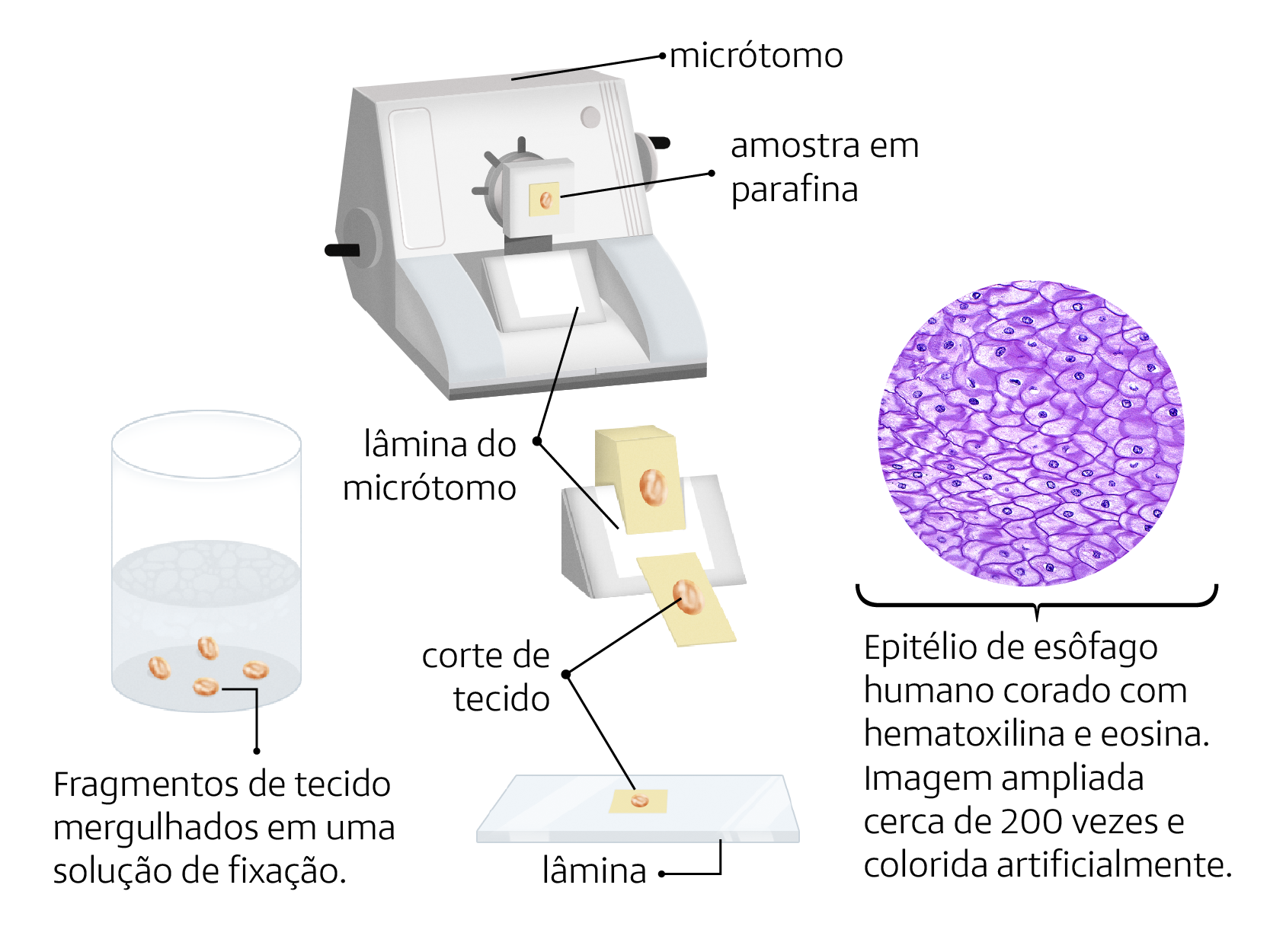 Esquema com ilustrações e textos. À esquerda, há um recipiente cilíndrico contendo um líquido transparente com pequenos fragmentos arredondados submersos a ele. Está indicado que são fragmentos de tecido mergulhados em uma solução de fixação. No centro, há um equipamento denominado micrótomo, uma máquina com alavancas nas laterais, no centro da qual há uma manivela conectada à parte onde está um fragmento de tecido dentro de um bloco sólido, o que corresponde à amostra em parafina. Logo abaixo, está a lâmina do micrótomo, de formato retangular. No esquema, há uma ampliação dessa lâmina evidenciando o corte do tecido, na qual o bloco sólido com o fragmento está na entrada da lâmina e, ao sair, é fino, com formato retangular. À direita, há uma ilustração em formato circular preenchida por várias camadas de células, umas sobre as outras, que têm formatos irregulares, em tons de roxo com núcleos em azul. Abaixo, há o texto: epitélio de esôfago humano corado com hematoxilina e eosina. Imagem ampliada cerca de 200 vezes e colorida artificialmente.