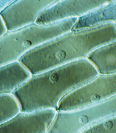 Fotografia do zoom microscópico de epiderme, uma superfície esverdeada composta por estruturas retangulares justapostas e algumas estruturas redondas menores sob elas.