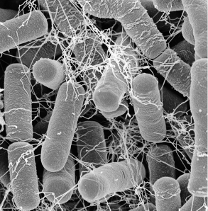 Fotografia em preto e branco de zoom microscópico de um aglomerado de estruturas com formato cilíndrico e extremidades arredondadas e, sobre elas, filamentos emaranhados.