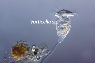 Fotografia de zoom microscópico de uma estrutura denominada Vorticella s p, com formato arredondado, semelhante a um cálice. Na parte superior, tem uma estrutura triangular com filamentos nas extremidades e, na porção inferior, um flagelo longo.