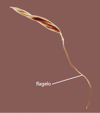 Fotografia de zoom microscópico de uma estrutura cilíndrica, fina, com aspecto retorcido e, um filamento longo na região inferior, denominado flagelo.