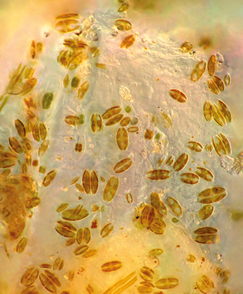 Fotografia de zoom microscópico de estruturas com formato cilíndrico, com extremidades arredondadas, dividida em 4 partes internamente.