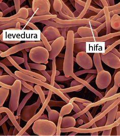 Fotografia de zoom microscópico de um emaranhado de estruturas cilíndricas e finas denominadas hifa, com uma estrutura redonda em uma extremidade, nomeada levedura.