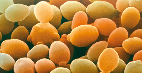 Fotografia de zoom microscópico de estruturas redondas semelhantes a grãos de uvas, com formações redondas menores na superfície. A coloração é alaranjada e esverdeada.