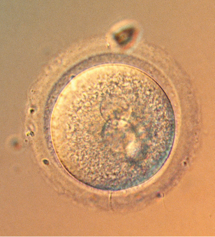 Fotografia do zoom microscópico de uma estrutura circular. Em torno dessa estrutura há uma camada irregular clara. E dentro da estrutura circular há duas estruturas circulares interligadas.
