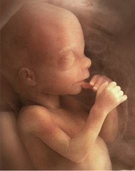 Fotografia de um feto com os braços e a cabeça já desenvolvidas. O feto está com as mãos próximo da boca e de olhos fechados.