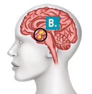 Ilustração da silhueta da cabeça de uma pessoa de perfil em corte. Na parte superior, encontra-se o cérebro, uma estrutura arredondada com dobras. Na esquerda, abaixo do cérebro, há um destaque de uma pequena parte amarela indicada pela letra B.