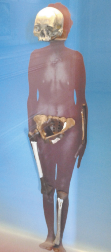 Imagem de réplicas de crânio, quadril, fêmur e tíbia fixadas em um painel, que representa um corpo feminino nu.