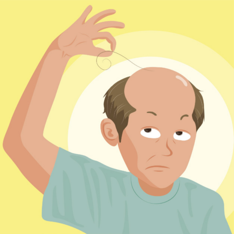 Imagem de homem arrancando um fio de cabelo. Ele possui cabelos nas laterais da cabeça e o topo é careca.