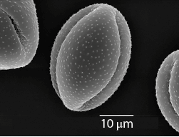 Fotografia microscópica em um fundo preto. Há uma forma oval em destaque contendo vários pontinhos dentro. Ela é clara e nas laterais do fundo há duas partes de outras formas. Na parte inferior está escrito: 10 micrômetros.