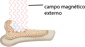 Ilustração de um osso com uma camada que possui várias manchas pequenas. Acima dessa camada há um material de vidro e várias setas apontando para a camada, com a indicação de campo magnético externo.
