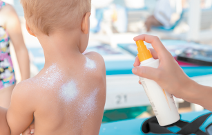 Fotografia de uma criança vista de costas, enquanto há uma mão segurando um frasco de spray, passando um produto branco nas costas da criança.
