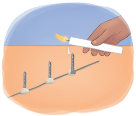 Ilustração de três parafusos com a cabeça sobre um fio condutor. Dois parafusos estão fixados e sobre o terceiro parafuso há uma mão segurando uma vela acesa inclinada com uma gota de parafina caindo.