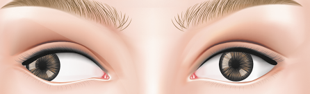 Ilustração dos olhos desalinhados de uma pessoa, com um deles virado para fora, em direção oposta ao nariz, enquanto o outro permanece na posição central.