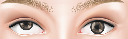 Ilustração dos olhos desalinhados de uma pessoa, com um deles voltado para cima, enquanto o outro permanece na posição central.
