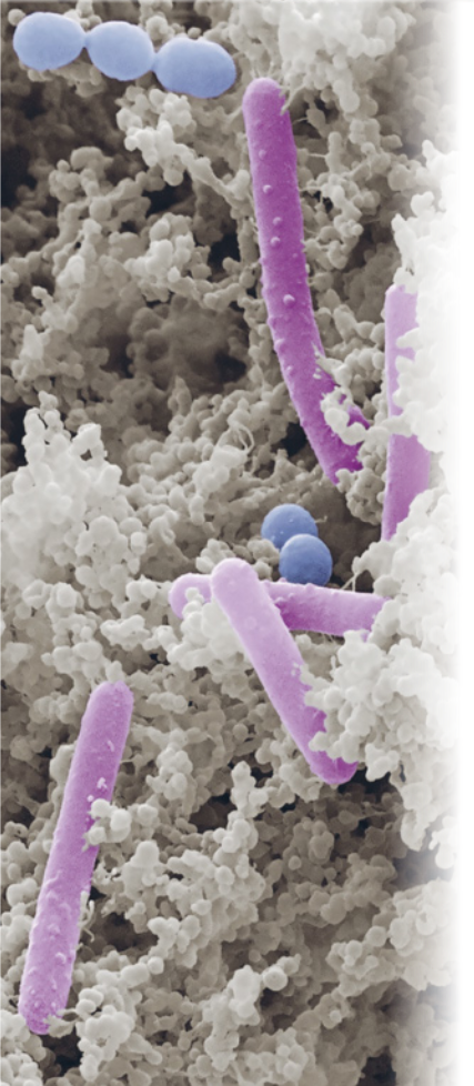 Fotografia obtida por meio de um microscópio, com predominância de uma textura irregular e granulosa na cor branca. Também são visíveis estruturas alongadas e cilíndricas em tons de rosa, além de pequenas esferas azuladas.