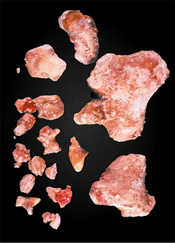 Fotografia de várias pedras em diferentes tamanhos e com formatos irregulares e coloração rosa avermelhada.