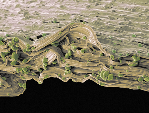 Fotografia microscopia de uma estrutura em camadas, com superfície ondulada e textura fibrosa. A estrutura apresenta várias camadas sobrepostas, dispostas de maneira irregular, com bordas dobradas. Pequenas esferas verdes estão dispersas sobre e entre as camadas.