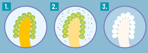Ilustração dividida em três partes numeradas. Em 1, há uma estrutura de formato cilíndrico disforme de coloração amarela com bolinhas verdes e pontos pretos grudados a sua volta. Em 2, a coloração do cilindro está mais clara e os pontos pretos das bolinhas estão em volta da estrutura. E em 3, toda estrutura está branca.