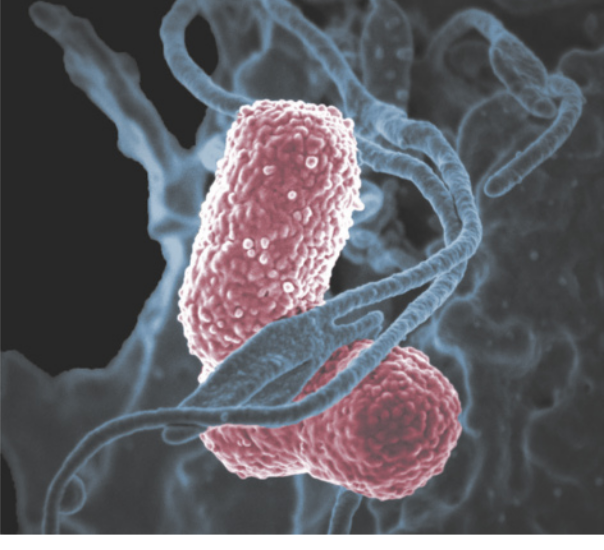 Imagem de uma bactéria vermelha enrolada em filetes de células azuis, obtidas por um microscópio.