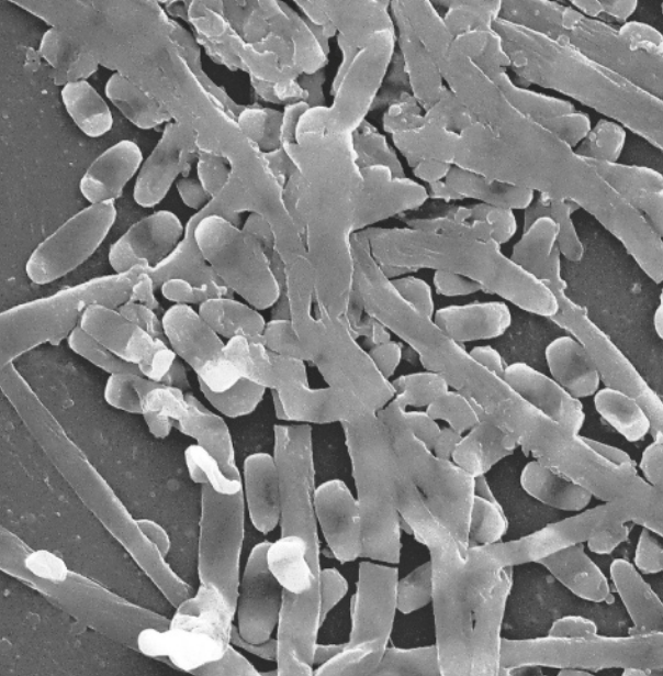 Imagem em preto e branco de filetes de fungos sobrepostos, obtidas por um microscópio.